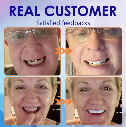 DentureGlow™ –🦷Get a Perfect Smile Fast!🦷 (⏰30-Min Flash Sale Ends Soon!⏰)