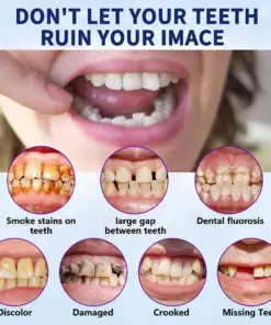 Nurbini® Advanced Customized Full Denture Set