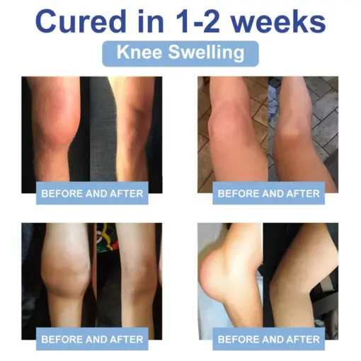 TAILEDEN™ Official Store: Magnesium Pain Healing Bone Cream