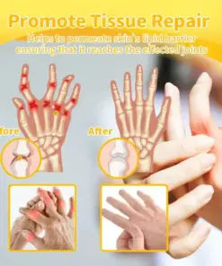 VENOLYX™ Bee Venom Rapid Therapy Joint Cream