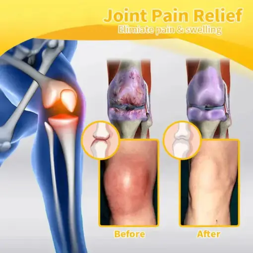 VENOLYX™ Bee Venom Rapid Therapy Joint Cream