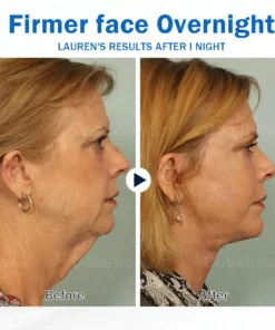Nurbini® Sleeping V-Face Beauty Device