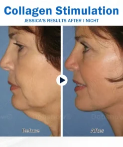 Nurbini® Sleeping V-Face Beauty Device