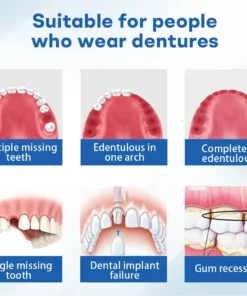 Nurbini® ThermoSeal Fresh Denture