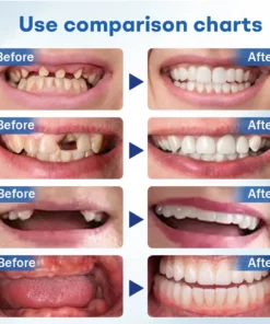 Nurbini® ThermoSeal Fresh Denture